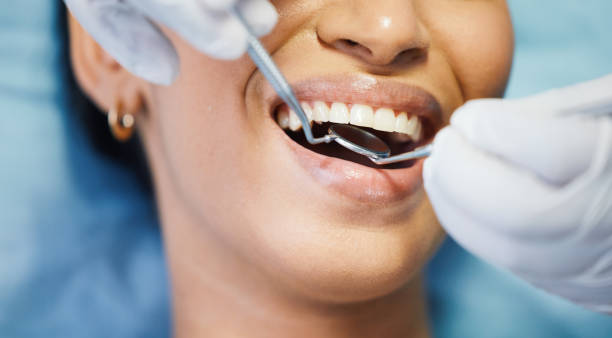 Professional Emergency Dental Service in MO